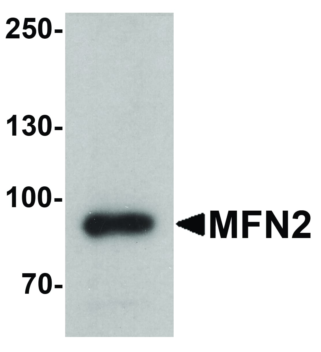 Mitofusin 2 / MFN2 Antibody