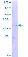 Human NOX4 Protein (Recombinant GST, N-terminus)