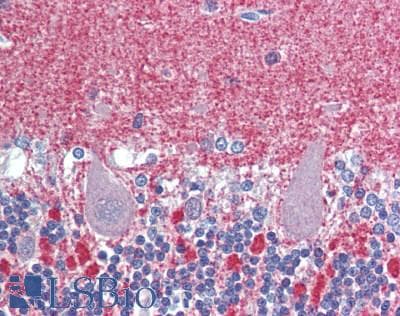 IHC-plus™ GCK / Glucokinase Antibody (aa1-300)