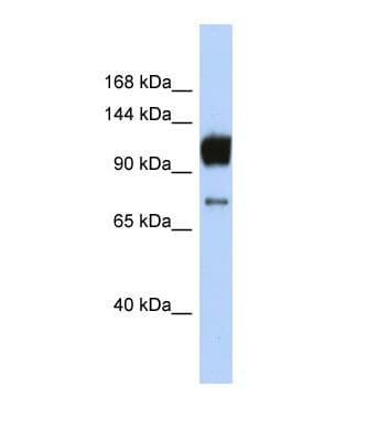 ABCA2 Antibody (aa96-145)