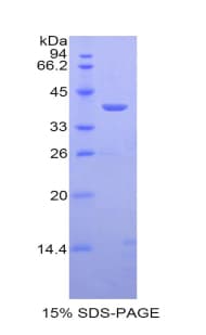 Mouse Calcitonin Protein (Recombinant His, N-Terminal)