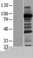 Human CBR / CBR1 Protein (Over-Expression Lysate Myc-DDK (Flag))