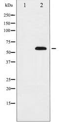 Polyclonal Rabbit anti-Human DOK2 Antibody (IHC, WB)