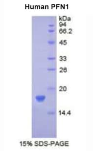 Human PFN1 / Profilin 1 Protein (Recombinant His)
