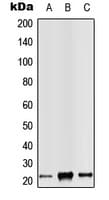 RAB14 Antibody (C-Terminus)