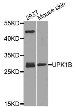 Polyclonal Rabbit anti-Human TSPAN20 / UPK1B Antibody (WB)