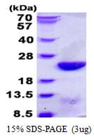 Human UBCH10 / UBE2C Protein (Recombinant His)