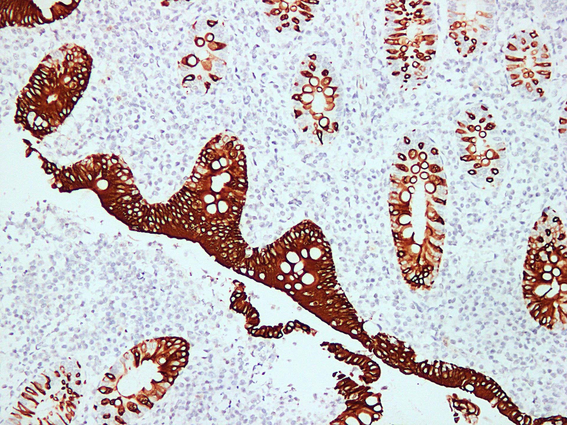 KRT20 / CK20 / Cytokeratin 20 Antibody (clone ABT-Ck20)