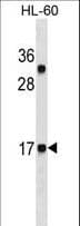CALCA Antibody (aa104-132, clone 406CT21.4.3)