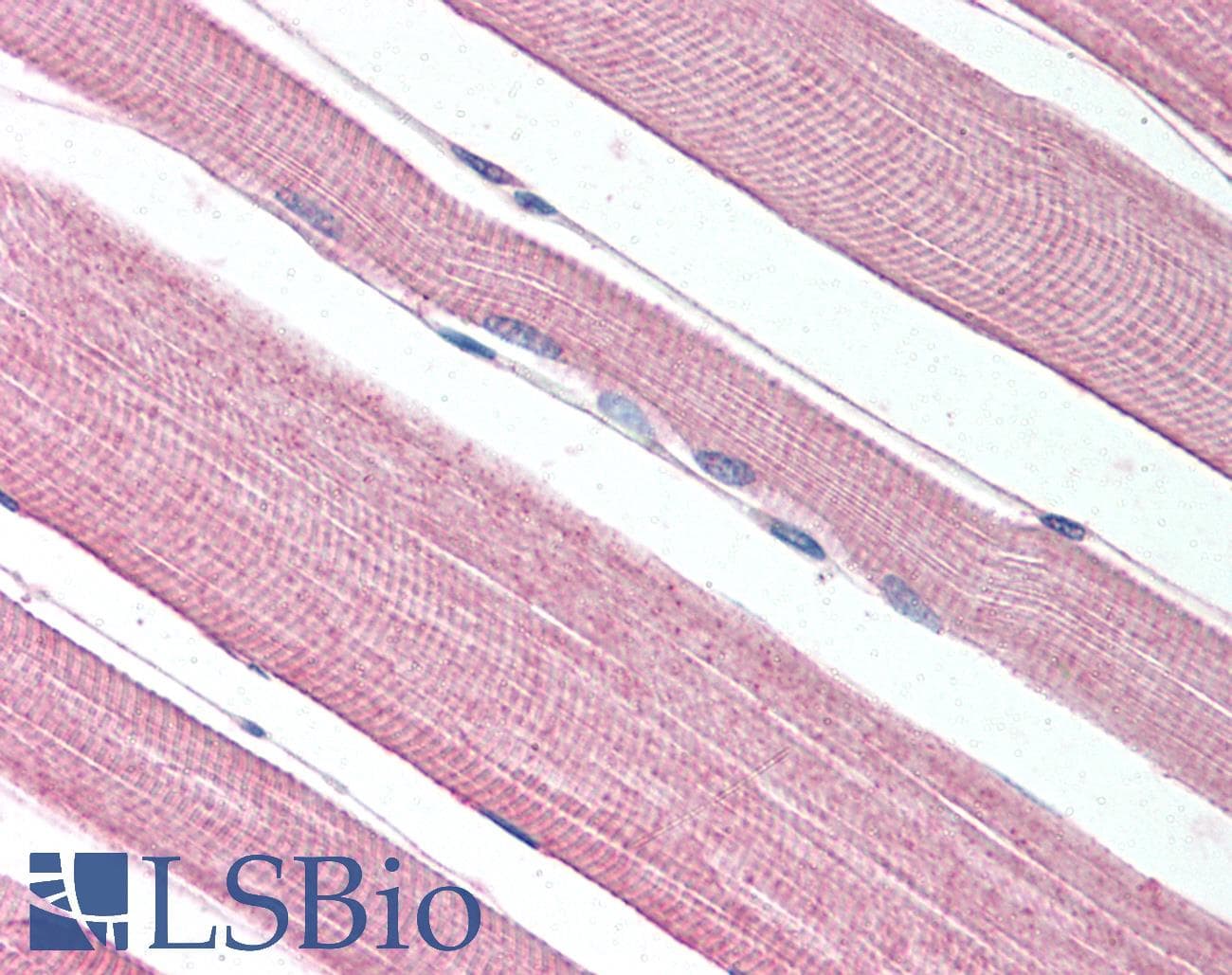 IHC-plus™ Polyclonal Rabbit anti-Human PROKR1 Antibody (N-Terminus, IHC, WB)