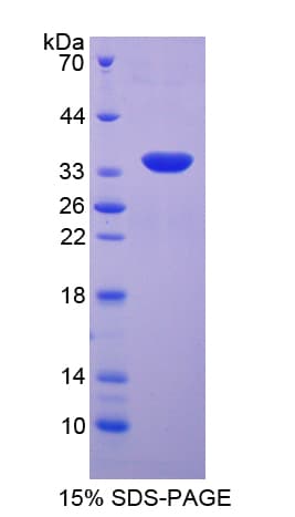 Human SGK3 Protein (Recombinant His-T7)
