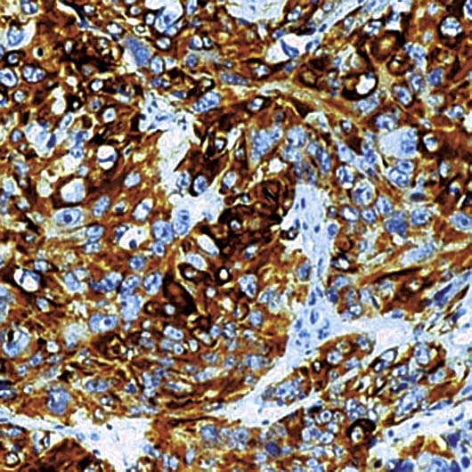 KRT14 / CK14 / Cytokeratin 14 Antibody (C-Terminus, clone LL002)