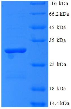Bacillus cereus mgsA / Methylglyoxal Synthase Protein (Recombinant His-SUMO)