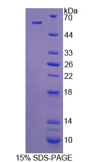 Human C1QTNF1 / CTRP1 Protein (Recombinant His-GST)