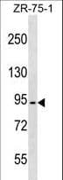 Pyrin / MEFV / MEF Antibody (aa418-445)