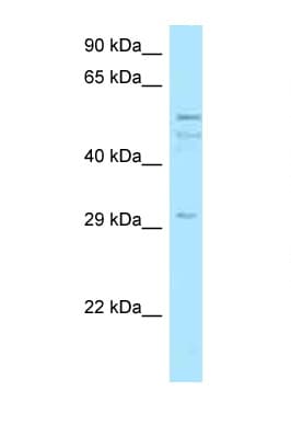 C11orf42 Antibody (aa259-308)