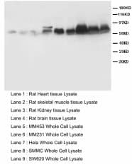 SMAD1+2+3+5 Antibody (aa442-456)