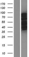 Human CPEB3 Protein (Over-Expression Lysate Myc-DDK (Flag))