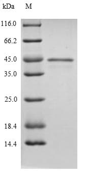 Bacillus mdh / Malate Dehydrogenase Protein (Recombinant 10His, N-terminus)