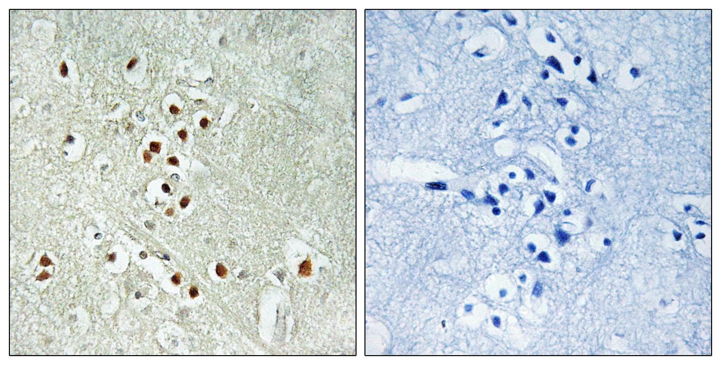 Polyclonal Rabbit anti-Human GADD45GIP1 / CRIF1 Antibody (IHC)