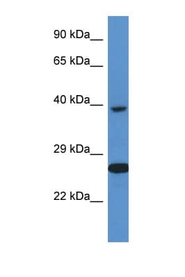 Polyclonal Rabbit anti-Human XRCC3 Antibody (C-Terminus, WB)