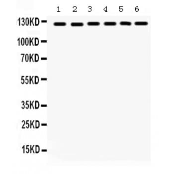FAK / Focal Adhesion Kinase Antibody (aa1024-1052)