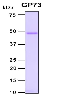 Human GOLM1 / GP73 / GOLPH2 Protein (Recombinant 6His, N-terminus)