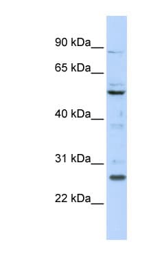 HOXC5 Antibody (N-Terminus)