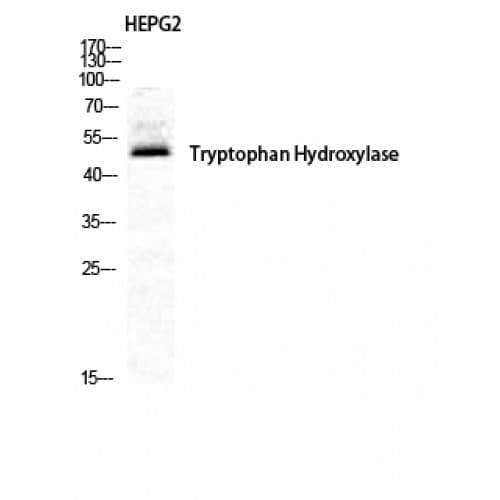 TPH1 / Tryptophan Hydroxylase Antibody (200-280 aa)