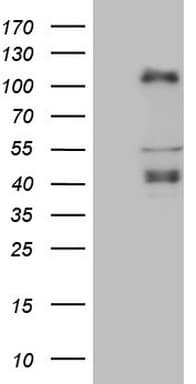 Monoclonal Mouse anti-Human CTBP2 Antibody (clone OTI4D4, Carrier-free, aa233-336, IHC, WB)