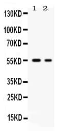 SLC2A5 / GLUT5 Antibody