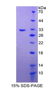 Rat TBX21 / T-bet Protein (Recombinant His-T7)