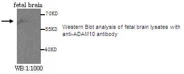 Polyclonal Rabbit anti-Human ADAM10 Antibody (WB)