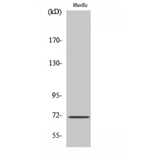 NF2 / Merlin Antibody (460-540 aa)