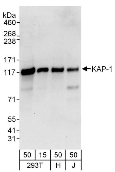 Polyclonal Goat anti-Human TRIM28 / KAP1 Antibody (aa1-50, IHC, WB)