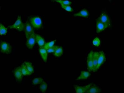 CCIN / Calicin Antibody