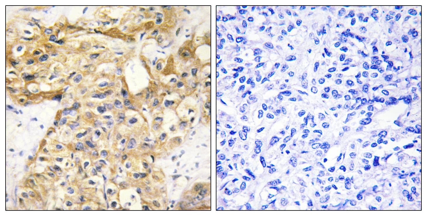 Endostatin Antibody