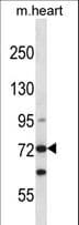 MYLK3 Antibody (aa174-203)