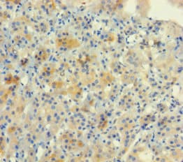 Polyclonal Rabbit anti-Human NUP153 Antibody (aa657-880, WB)