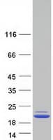 Human PRX / Periaxin Protein (Recombinant Myc-DDK (Flag))