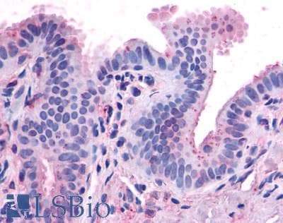 IHC-plus™ CCKAR / CCK1R Antibody (C-Terminus)