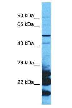 NTN5 Antibody (aa437-486)