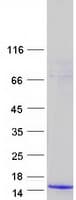 Human PMAIP1 / NOXA Protein (Recombinant Myc-DDK (Flag))