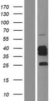 CYB5R3 / B5R Protein (Over-Expression Lysate Myc-DDK (Flag))