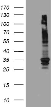 ABCB1 / MDR1 / P Glycoprotein Antibody (aa995-1280, clone OTI2H2)