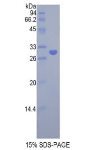 Rat LRPAP1 Protein (Recombinant His)