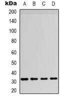BAFF / TNFSF13B Antibody (Internal)