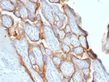 CGB / hCG Beta Antibody (clone SPM529)