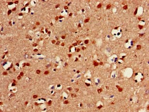 FOXC2 Antibody