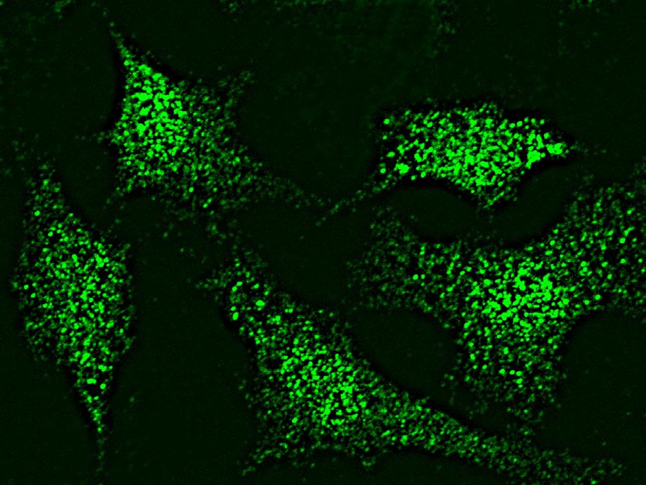 Polyclonal Rabbit anti-Human MAPK11 / SAPK2 / p38 Beta Antibody (Preservative Free, IHC, IF, WB)